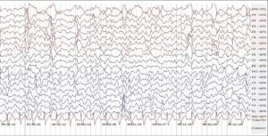 EEG Graph